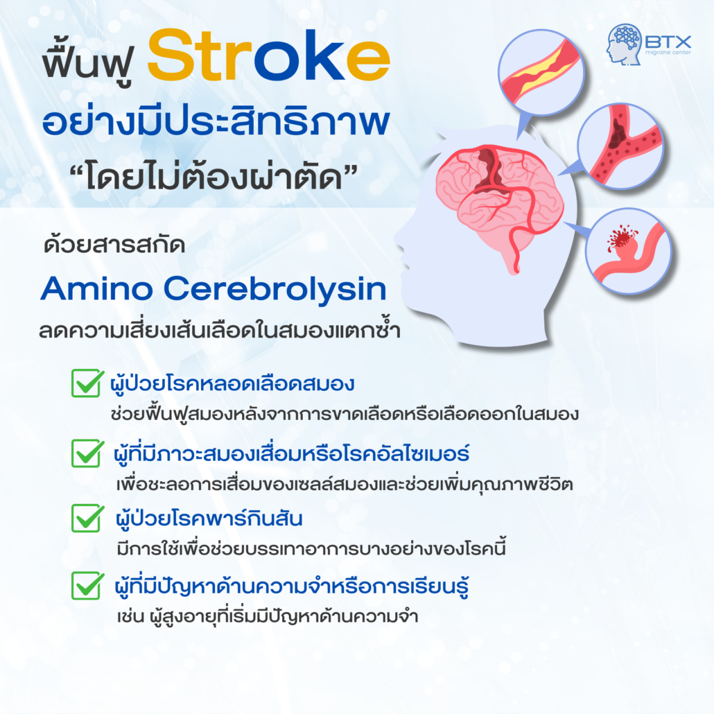 รักษาอาการ Stroke