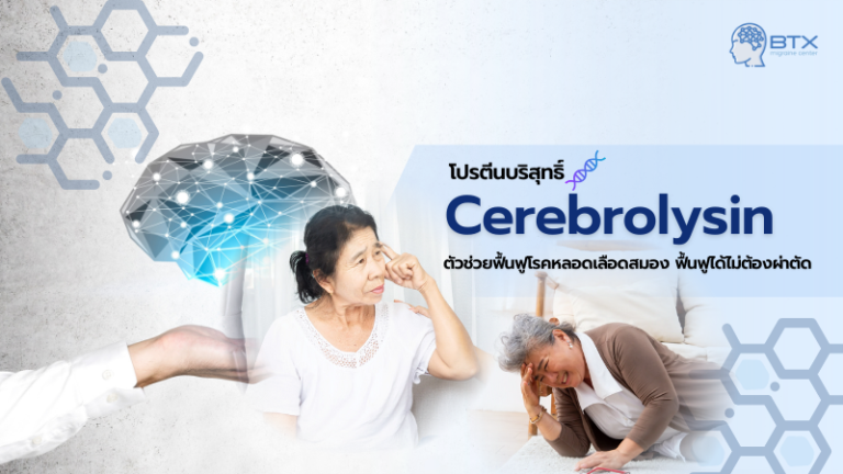 Cerebrolysin การรักษา Stroke และโรคอื่นๆ ที่สามารถรักษาด้วยยา